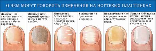 Белые полоски на ногтях рук и ног – причины и лечение| 
