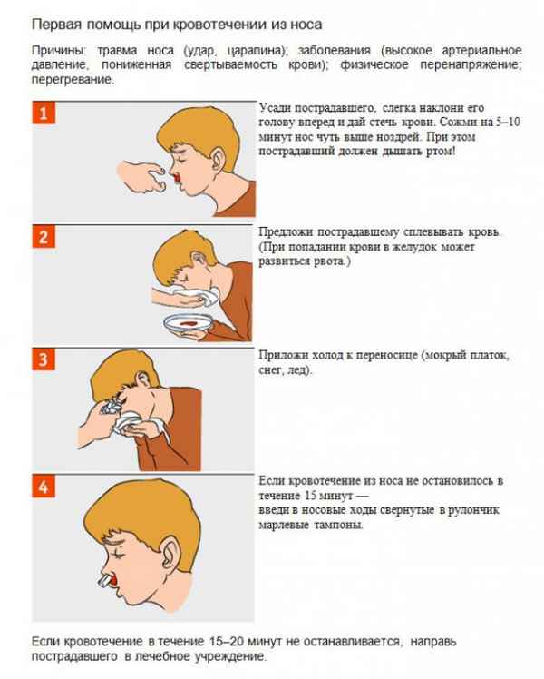 Как остановить кровь из носа: что делать если она течет, как остановить